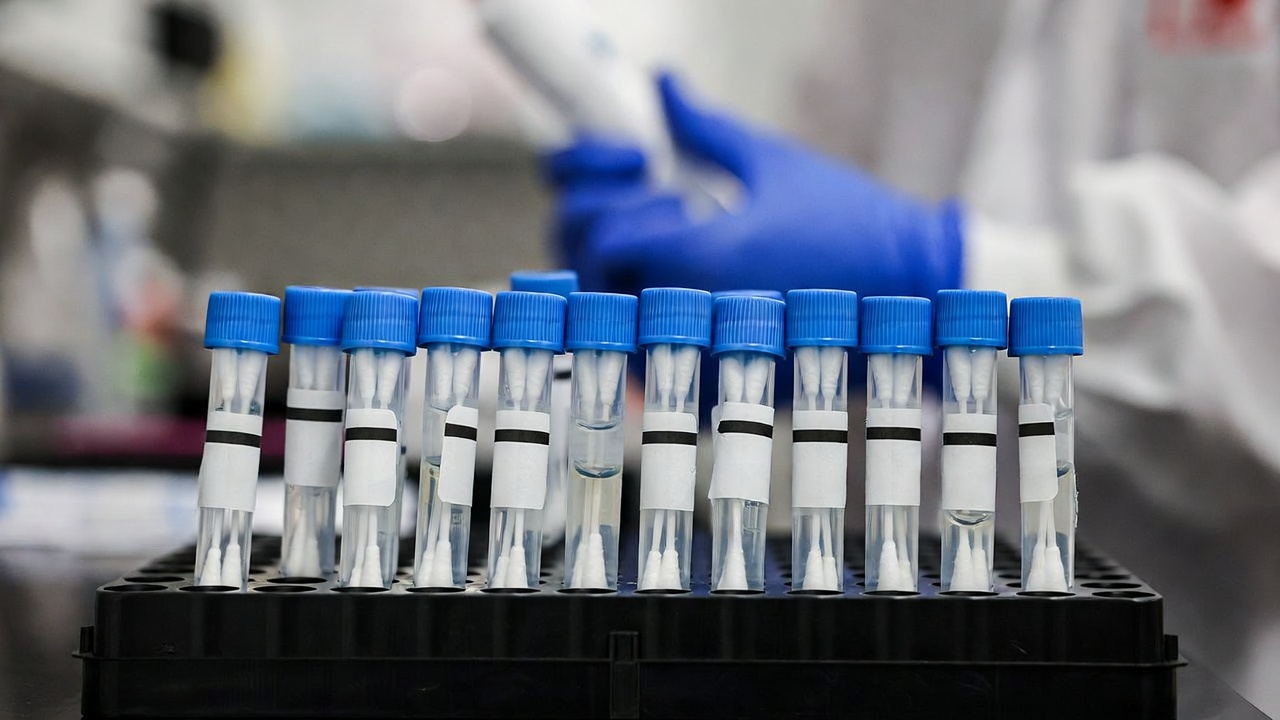 Provette per tamponi disposte in una rastrelliera su un banco di laboratorio