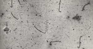Leptospirosi, cos’è la malattia dei casi a Zante: sintomi e come si prende